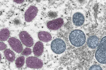 Porto Alegre registra novo caso de Mpox e prefeitura intensifica orientações de prevenção para o Carnaval 6 Caso de Mpox é confirmado em Porto Alegre